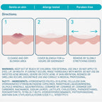 CeraVe Hydrocolloid Blemish Patches, Pimple Patches for Face, 22ct | Absorbs Oil with Niacinamide and Ceramides, Ultra-Thin Acne Patches That Blend Into All Skin Tones, For Sensitive Skin
