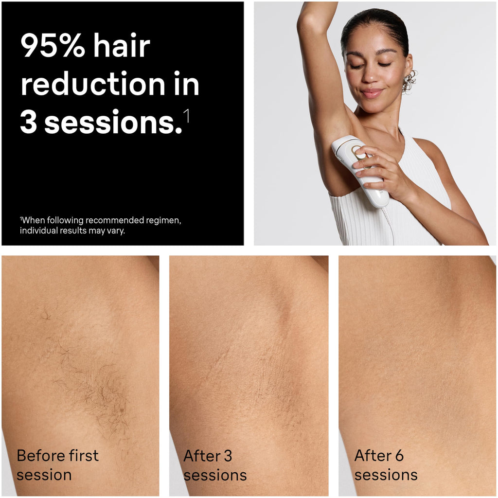 Braun IPL, Silk·Expert Pro 5, IPL Hair Removal for Women and Men, Permanent Laser Hair Reduction At-Home, 4 Heads, IPL5347