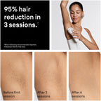 Braun IPL, Silk·Expert Pro 5, IPL Hair Removal for Women and Men, Permanent Laser Hair Reduction At-Home, 4 Heads, IPL5347