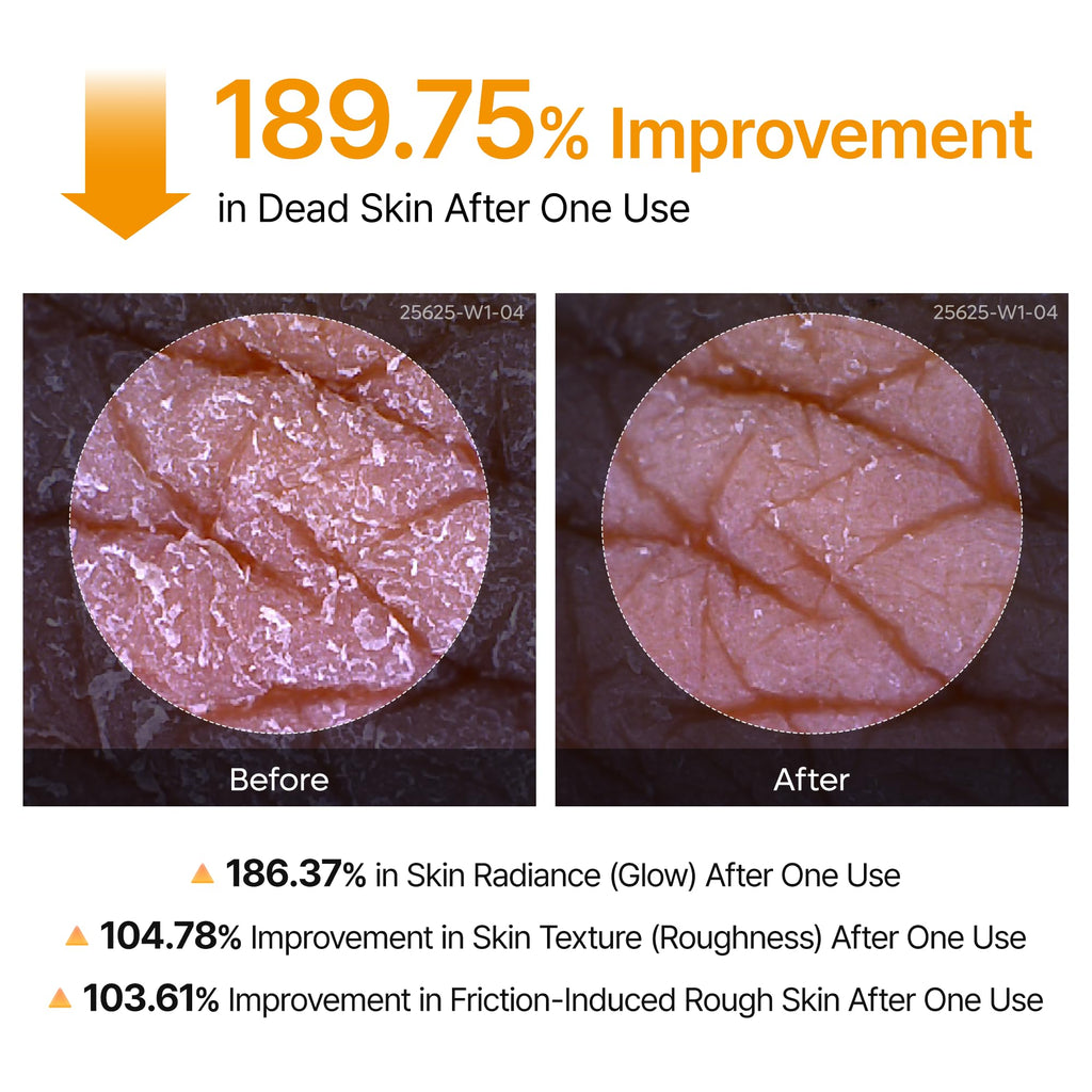Dr.Melaxin Peel Shot Kojic Acid Turmeric Body Exfoliator Spray 6.76 fl.oz - AHA PHA Niacinamide Body Scrub for KP Bumps, Dark Spots, Uneven Skin Tone, Dead Skin, Korean Skin Care