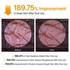Dr.Melaxin Peel Shot Kojic Acid Turmeric Body Exfoliator Spray 6.76 fl.oz - AHA PHA Niacinamide Body Scrub for KP Bumps, Dark Spots, Uneven Skin Tone, Dead Skin, Korean Skin Care