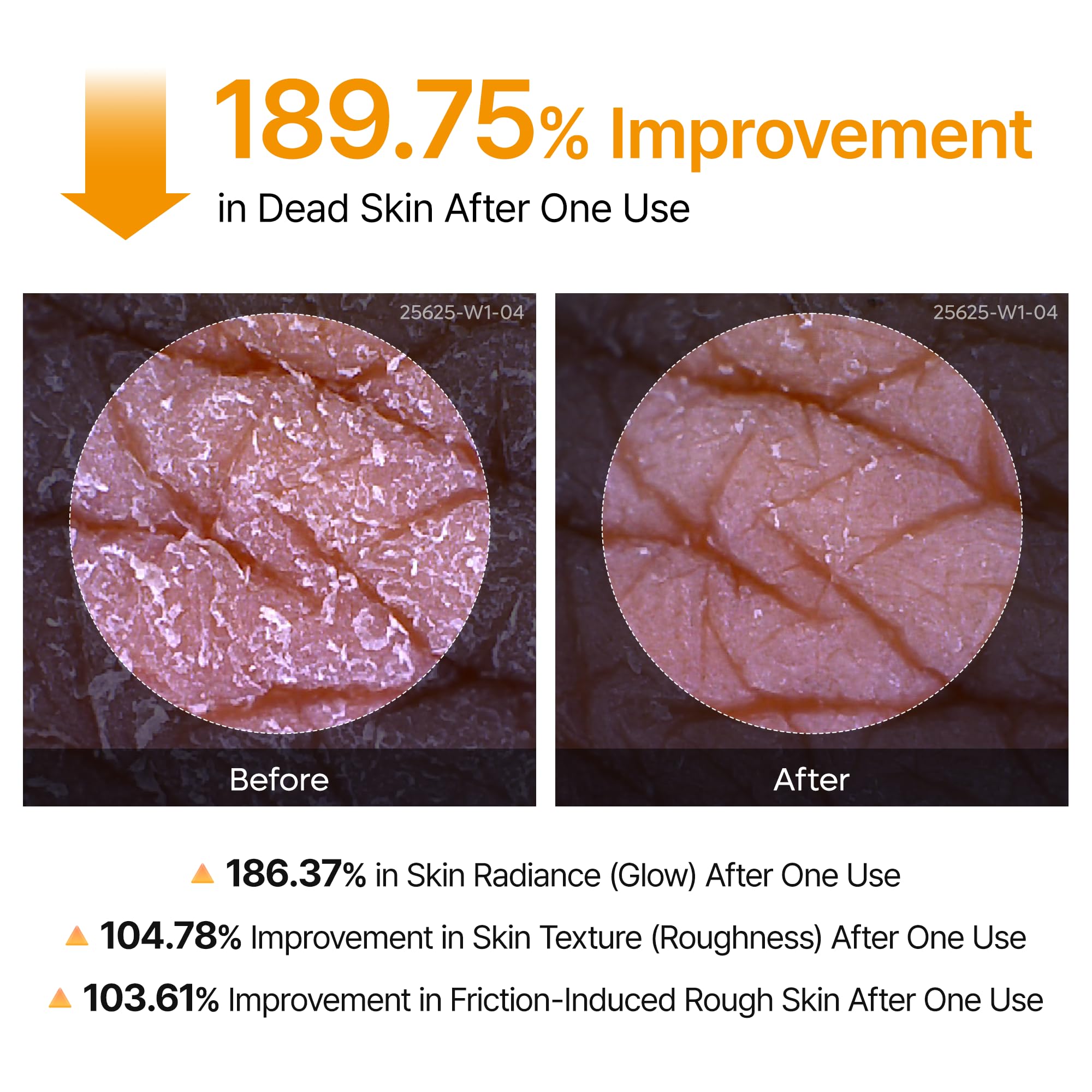 Dr.Melaxin Peel Shot Kojic Acid Turmeric Body Exfoliator Spray 6.76 fl.oz - AHA PHA Niacinamide Body Scrub for KP Bumps, Dark Spots, Uneven Skin Tone, Dead Skin, Korean Skin Care