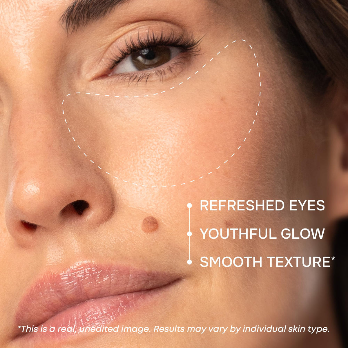 Collagen Eye Patches for Puffy Eyes - Retinol, Hyaluronic Acid, 15 Pairs