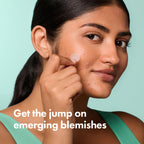 Mighty Patch Hero Cosmetics Micropoint Acne Pimple Patches, 8 Ct | For Early Stage Zits & Hidden Blemishes; Hydrocolloid with Salicylic Acid, Niacinamide, Cica; 395 Micropoints; Acne Stickers