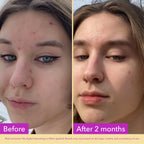 Good Molecules Niacinamide Serum 10%, Pore & Texture Serum, 1 fl oz | 10% niacinamide serum to refine skin texture and minimize the look of pores. Non-comedogenic.