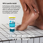 AmLactin Foot Repair Cream, 15% Lactic Acid for Cracked Heels, 3 oz | 15% lactic acid foot cream exfoliates, softens calluses and moisturizes dry, cracked heels and rough feet without scrubbing.