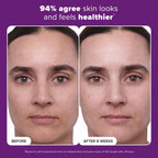 Buy now Paula's Choice CLINICAL 1% Retinol Face Treatment with Peptides, Vitamin C & Licorice Extract, Anti-Aging Skin Care Serum, Fine Lines & Wrinkles, Fragrance Free at indiglob india