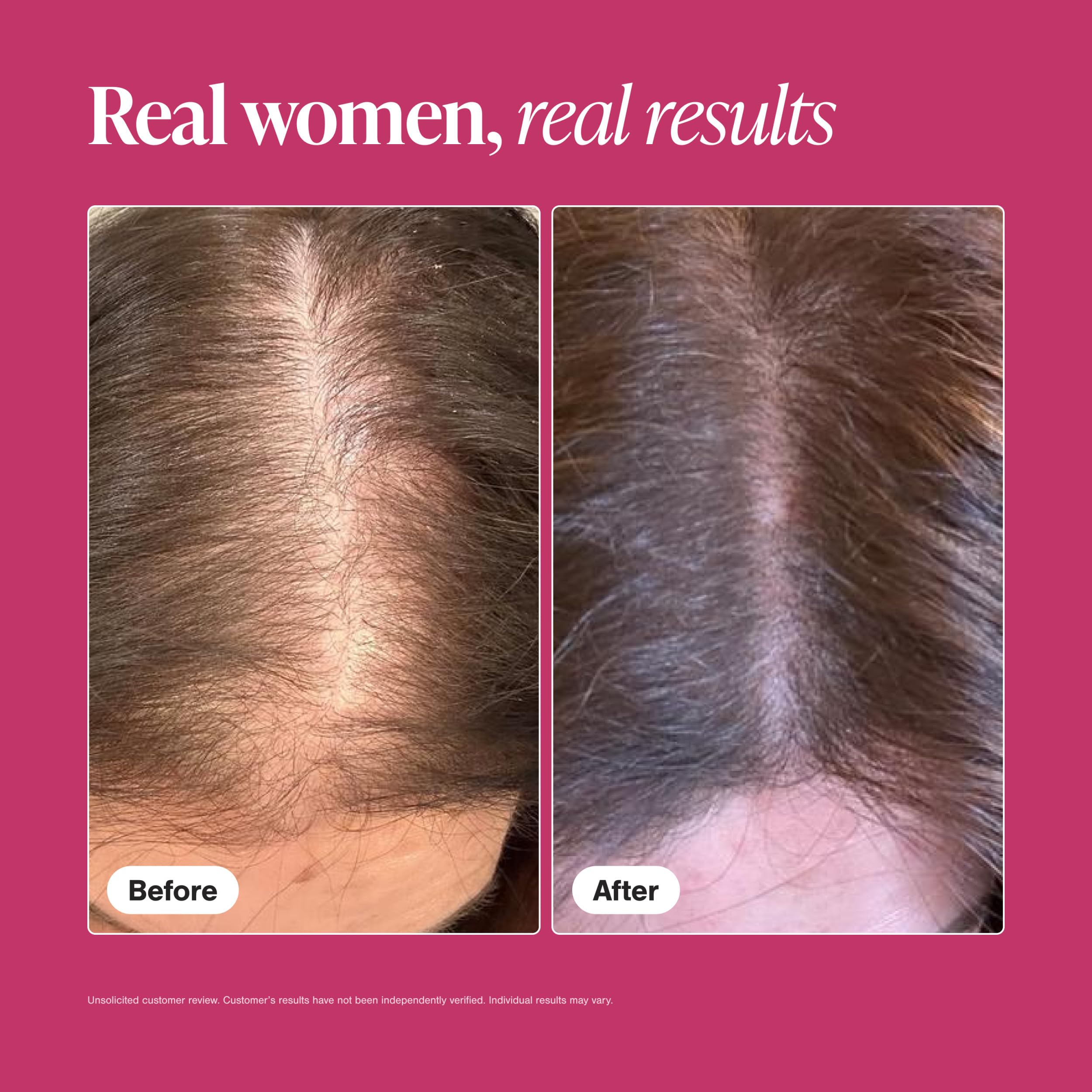 Viviscal Hair Growth Supplements for Women, 60 Tablets, 1 Month | For Thicker & Fuller Hair, Thinning Hair Support, Biotin & Marine Collagen, Drug-Free