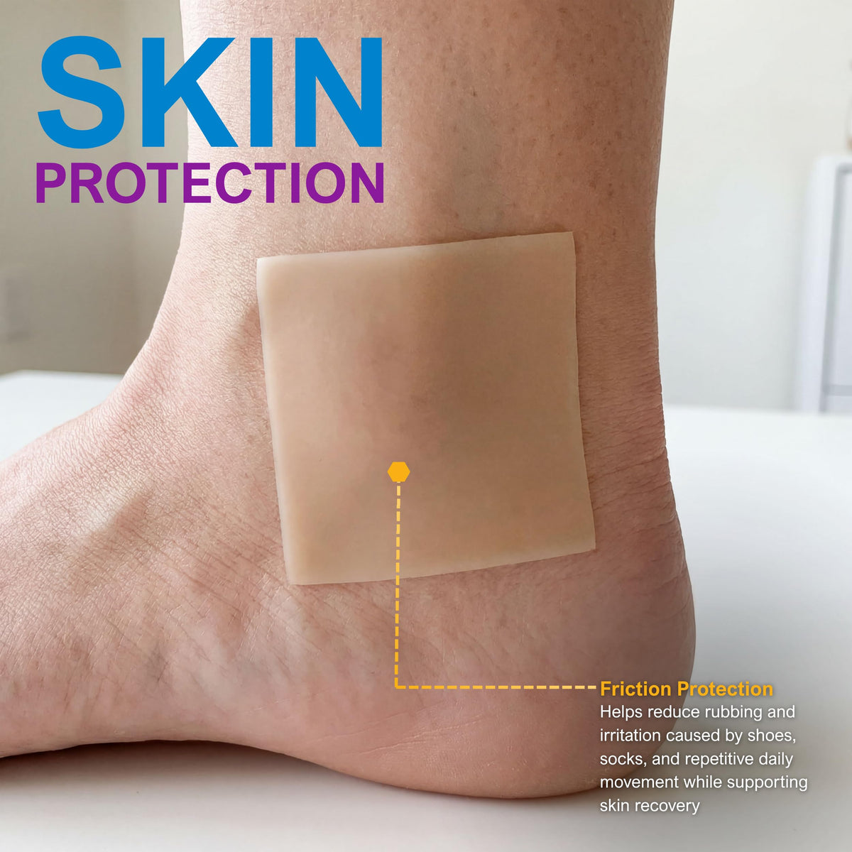 MED PRIDE Silicone Wound and Scar Tape Roll 1.5 in x 1.6 Yards,Waterproof