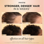 Pantene Abundant & Strong Daily Scalp Serum, Strengthens Scalp’s Hold on Roots, 2 oz