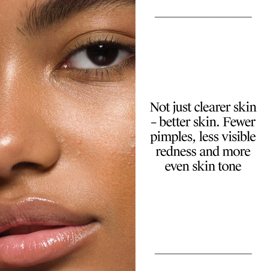 Neutrogena Oil Free Acne Face Wash, 9.1 fl. oz, 3 Pack | Salicylic Acid, Noncomedogenic, Residue-Free Facial Cleanser, Suitable for Oily Skin, Easy-Pump Bottles