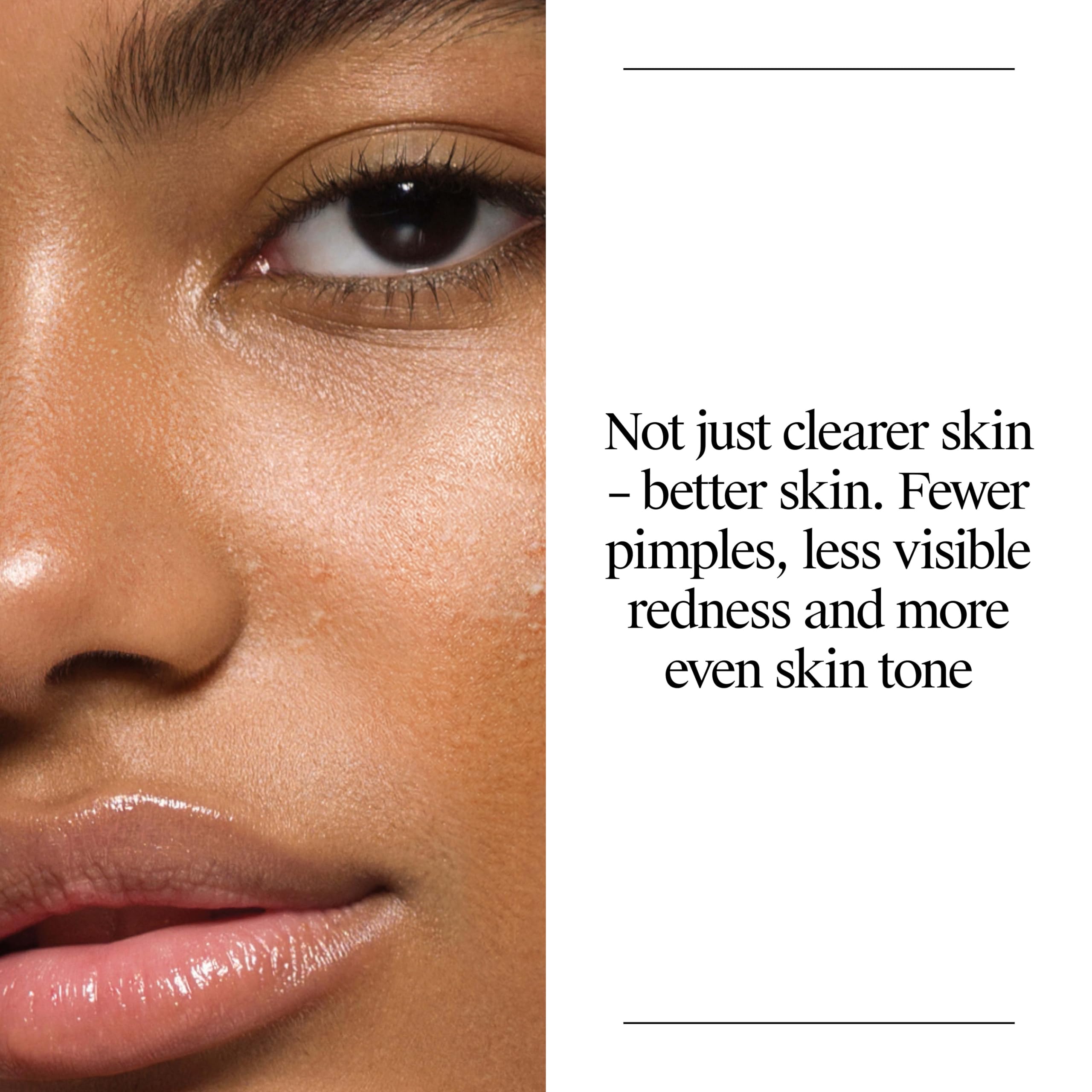 Neutrogena Oil Free Acne Face Wash, 9.1 fl. oz, 3 Pack | Salicylic Acid, Noncomedogenic, Residue-Free Facial Cleanser, Suitable for Oily Skin, Easy-Pump Bottles