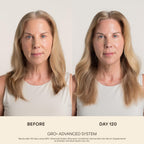 VEGAMOUR GRO+ Advanced Balancing Shampoo, MD-Formulated, Color Safe