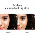 Neutrogena Rapid Clear Stubborn Acne Spot Treatment Gel, 1 oz