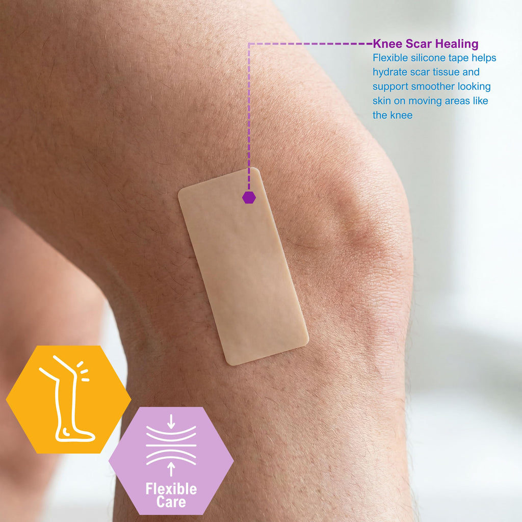 MED PRIDE Silicone Wound and Scar Tape Roll 1.5 in x 1.6 Yards,Waterproof