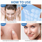Daolyo Pimple Patches for Face, 4 Size 300 Counts Hydrocolloid Acne Patches | Pimple Patches for Covering Zits and Blemishes, Spot Stickers with Salicylic Acid, Tea Tree Oil & Calendula Oil