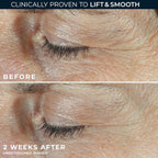 RoC Derm Correxion Dual Eye Cream, Retinol + Peptides for Puffy Eyes 0.68oz | 2 in 1 Eye Treatment developed with dermatologists. Lift upper eye with lifting gel and smooth lower eye with smoothing cream
