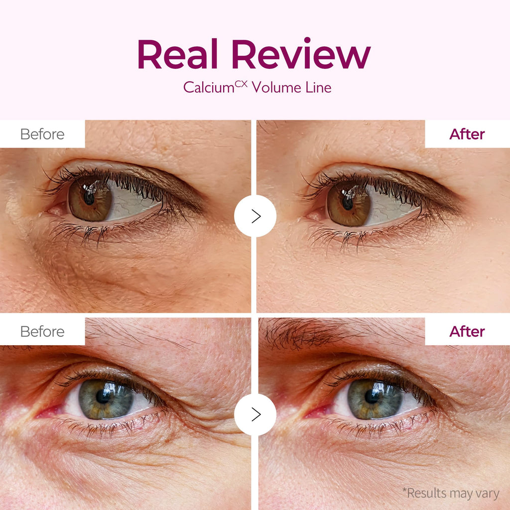 Dr.Melaxin Calcium Volume Under Eye Patches for Puffy Eyes & Dark Circles, Hydrogel Eye Mask for Wrinkles, Fine Lines & Sagging Skin, Firming Collagen Eye Patch, Korean Skin Care (60 Count)
