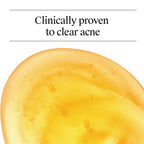 Neutrogena Oil Free Acne Face Wash, 9.1 fl. oz, 3 Pack | Salicylic Acid, Noncomedogenic, Residue-Free Facial Cleanser, Suitable for Oily Skin, Easy-Pump Bottles