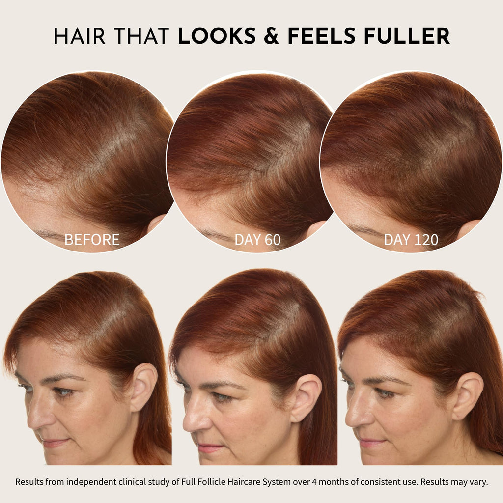 Maelove Full Follicle Advanced Scalp Serum with Peptides and Growth Factors