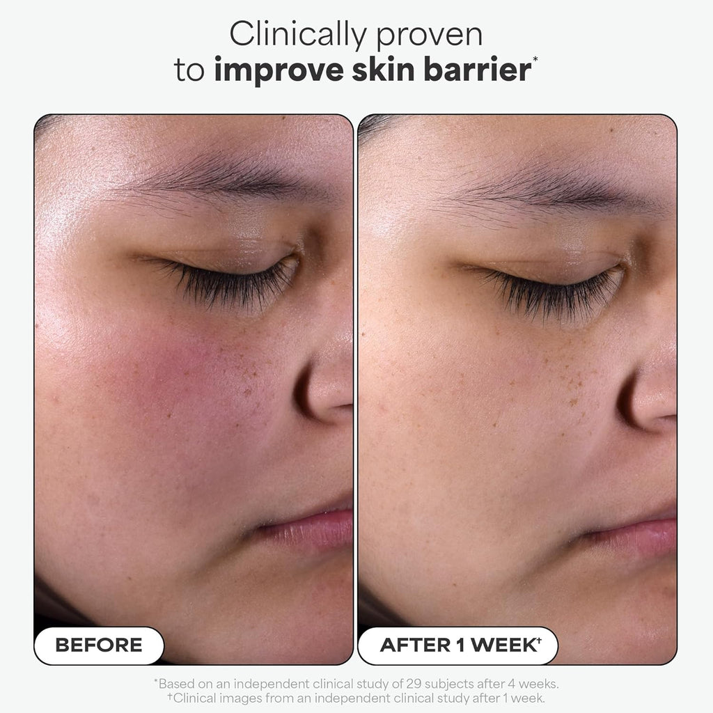 Buy now Paula's Choice SKIN PERFECTING 2% BHA Liquid Exfoliant with Salicylic Acid, Facial Polish for Enlarged Pores, Wrinkles & Fine Lines, Suitable for Blackhead-Prone Skin, Fragrance-Free at indiglob india
