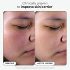 Buy now Paula's Choice SKIN PERFECTING 2% BHA Liquid Exfoliant with Salicylic Acid, Facial Polish for Enlarged Pores, Wrinkles & Fine Lines, Suitable for Blackhead-Prone Skin, Fragrance-Free at indiglob india