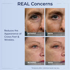Plexaderm Eye Serum Pump - Visibly Reduces Bags, Wrinkles & Dark Circles | Instant eye serum with pump dispenser—visibly reduces under-eye bags, puffiness, wrinkles & dark circles in minutes.