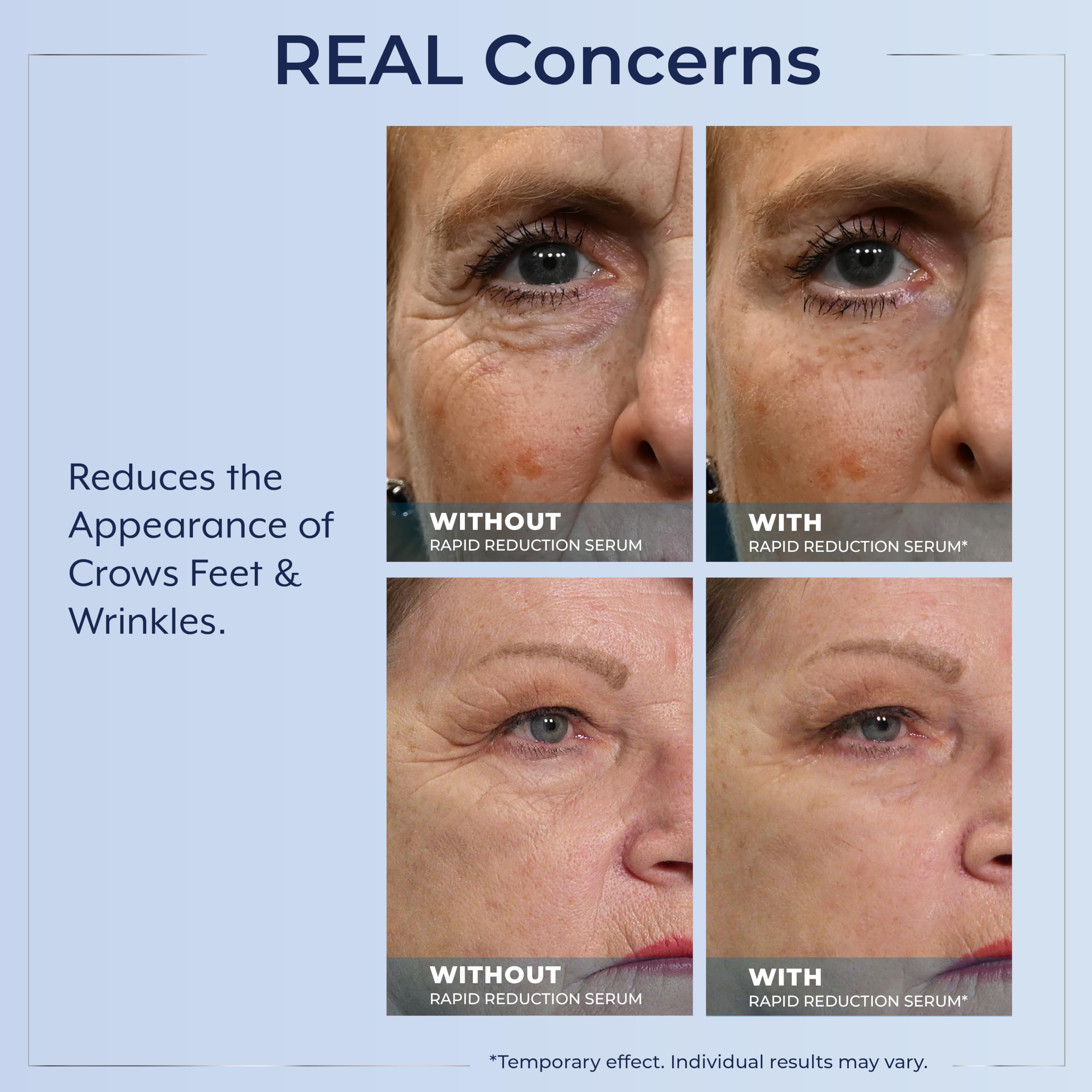 Plexaderm Eye Serum Pump - Visibly Reduces Bags, Wrinkles & Dark Circles | Instant eye serum with pump dispenser—visibly reduces under-eye bags, puffiness, wrinkles & dark circles in minutes.