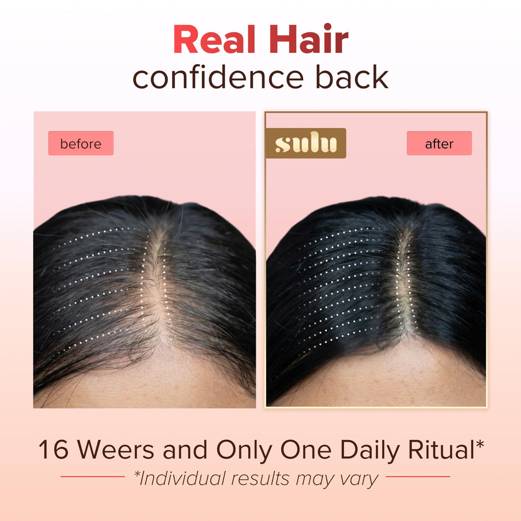 SULU Hair Growth Gummies - Biotin Supplements for Women - Hair Regrowth Skin Nails Vitamins