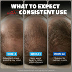 Kirkland Minoxidil for Men Liquid, Extra Strength Hair Regrowth Treatment 5%, 6 Months Supply - Upgraded Dropper Applicator and Bonus Free Guide Included