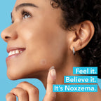 Noxzema Hydrocolloid Pimple Patches with Niacinamide & Tea Tree Extract, Acne Treatment for Face Blemishes, Absorbs Oil & Reduces Breakouts, Dermatologist Tested, 30 Count