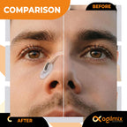 Refill Magnetic Nose Strips for Breathing, Nasal Strips, 30-Days-Nude
