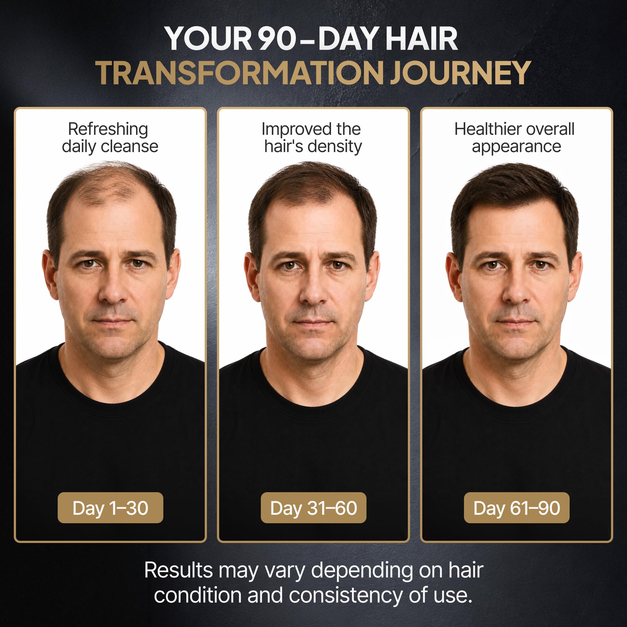 SPARTAN™ Root Activator Shampoo For Men - Hair Growth Shampoo for Hair Loss and Thinning Hair