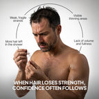 SPARTAN™ Root Activator Shampoo For Men - Hair Growth Shampoo for Hair Loss and Thinning Hair