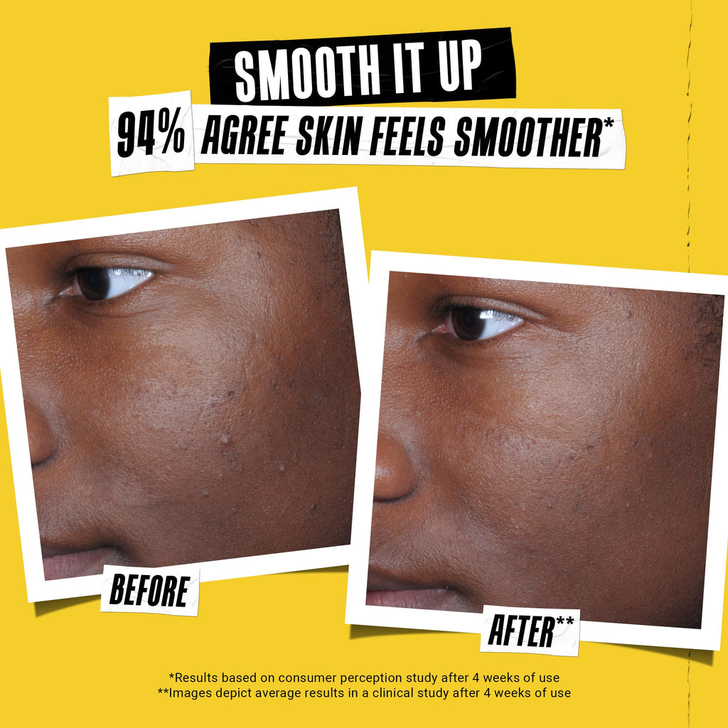 Kiehl's - Better Screen UV Serum SPF 50+ Facial Sunscreen, Collagen Peptide | Facial Sunscreen for Shielding UVA & UVB - With Collagen Peptide - Corrects Visible Signs of Aging