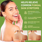 Roycederm Antifungal Bar Soap - Tea tree Oil Soap - Athlete’s Foot Treatment for Jock Itch & Ringworm - Medicated Antifungal Soap with Clotrimazole 1% - Tea Tree Oil Scent, 1 Pack