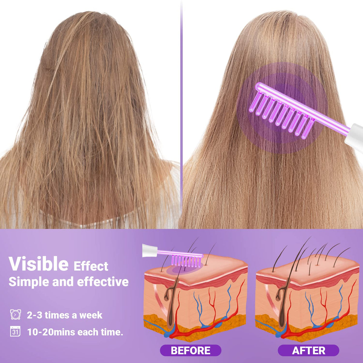 High Frequency Facial Wand-UUPAS Portable Handheld High Frequency