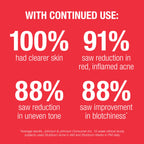 Neutrogena Stubborn Acne AM Face Treatment, 2.0 oz | 2.5% Micronized Benzoyl Peroxide Acne Treatment, Oil Free Daily Facial Treatment, Reduces Size & Redness of Breakouts