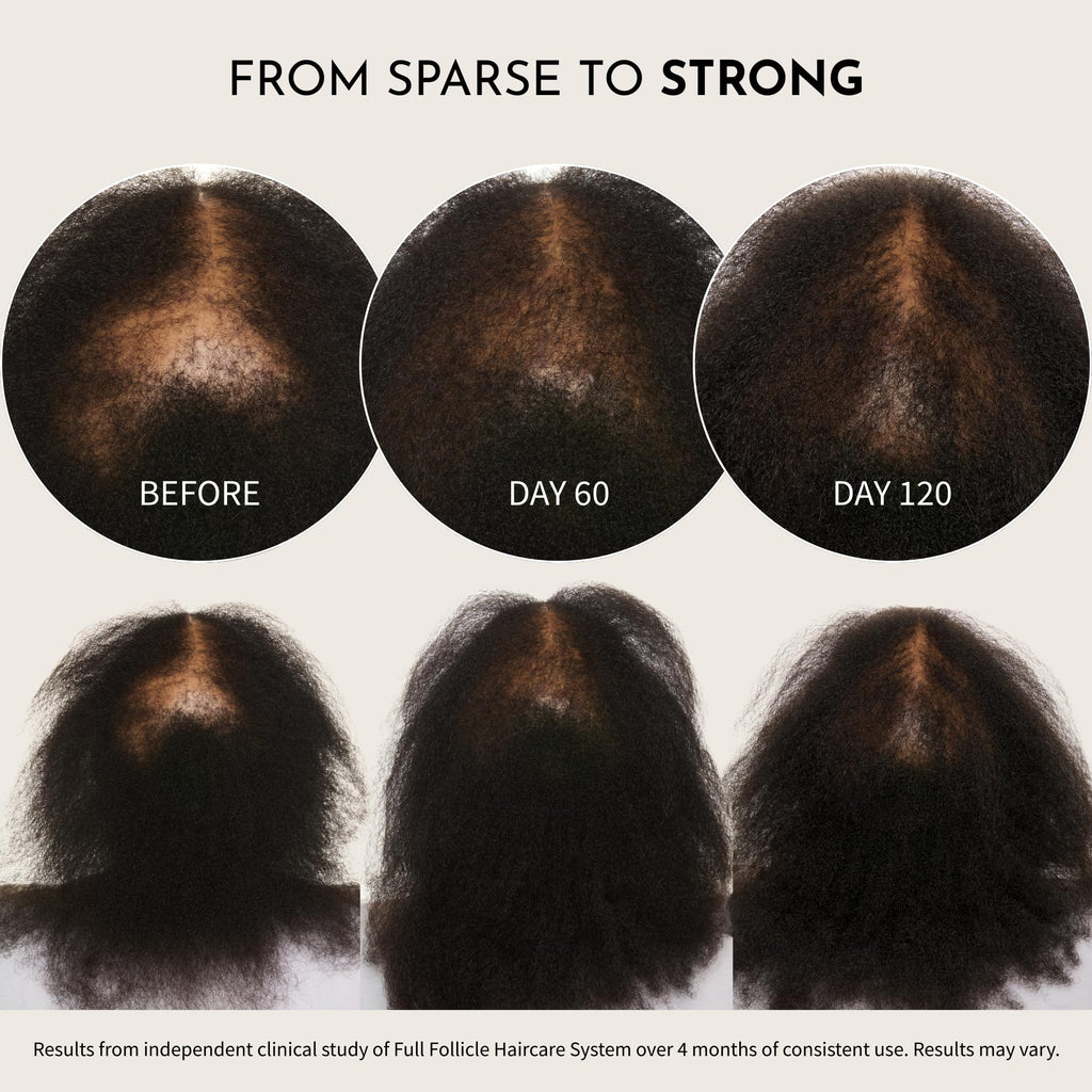 Maelove Full Follicle Advanced Scalp Serum with Peptides and Growth Factors