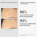 Murad Retinol Youth Renewal Night Cream - Anti-Aging Moisturizer with Retinol Tri-Active Technology and Niacinamide Gently Fights Wrinkles and Fine Lines, Boosts Radiance and Firms Skin - 1.7 Fl Oz