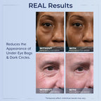 Plexaderm Rapid Reduction Serum - Visibly Reduces Under-Eye Bags & Wrinkles | Instant eye serum that visibly reduces under-eye bags, puffiness, wrinkles & dark circles in minutes, lasting up to 10 hours