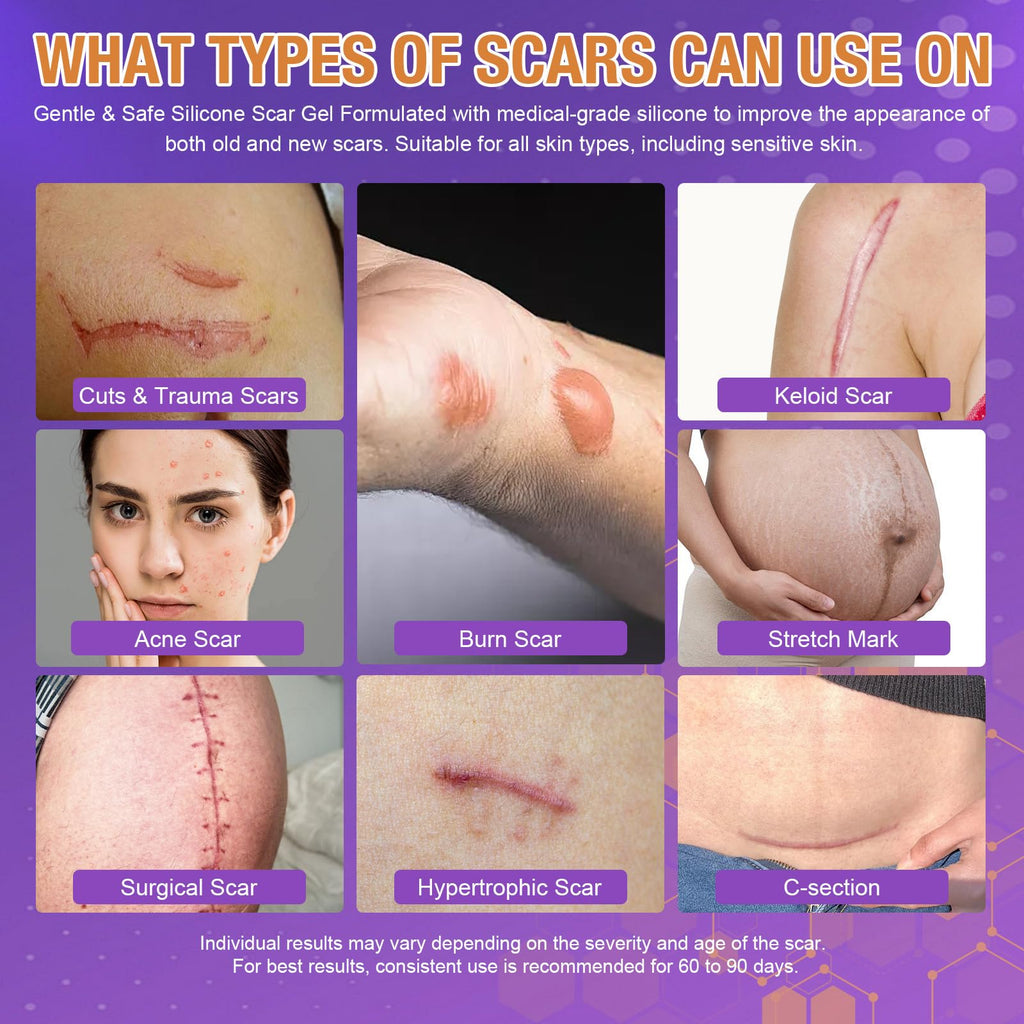 Silicone Scar Gel for Old and New Scars, Quick-Dry Scar Care for Face & Body, Helps Smooth, Soften & Flatten Raised Scars from C-Section, Burns, Acne & Surgery