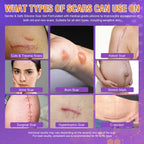 Silicone Scar Gel for Old and New Scars, Quick-Dry Scar Care for Face & Body, Helps Smooth, Soften & Flatten Raised Scars from C-Section, Burns, Acne & Surgery