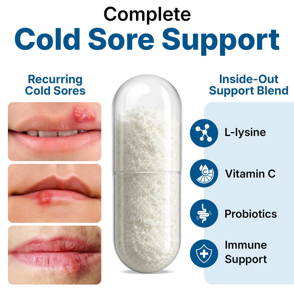 Lysine Cold Sore Treatment, L-Lysine Capsules with Probiotics & Vitamin C | Stops Outbreaks Before They Start, Internal Lysine Defense, Not A Topical Cover-up For Cold Sores