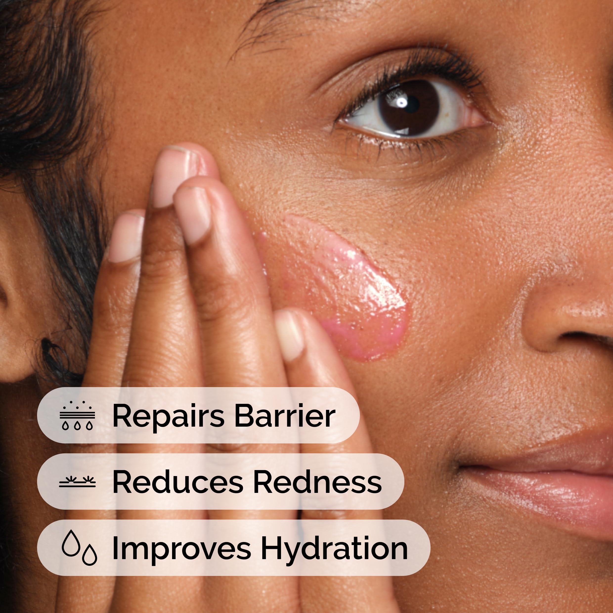 The Ordinary Soothing & Barrier Support Serum, Redness-Reducing & Hydrating Solution with Centella Asiatica for Skin Barrier Repair