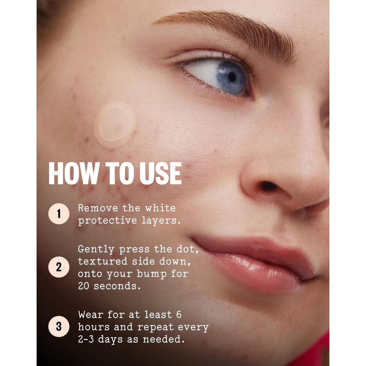 PEACE OUT Early Stage Acne Microneedling Hydrocolloid Dots (8 Count)