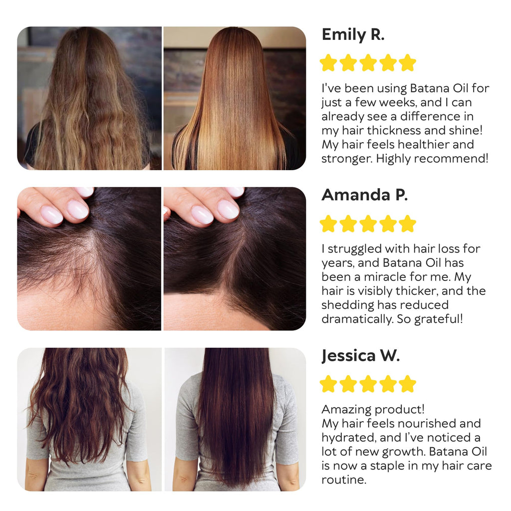 Batana Oil for Hair Growth - 100% Raw & Organic Unrefined Batana Oil - Cold Pressed Hair Mask for Scalp Health, Thicker Hair & Split Ends Repair - Natural & Pure (4.23 oz)