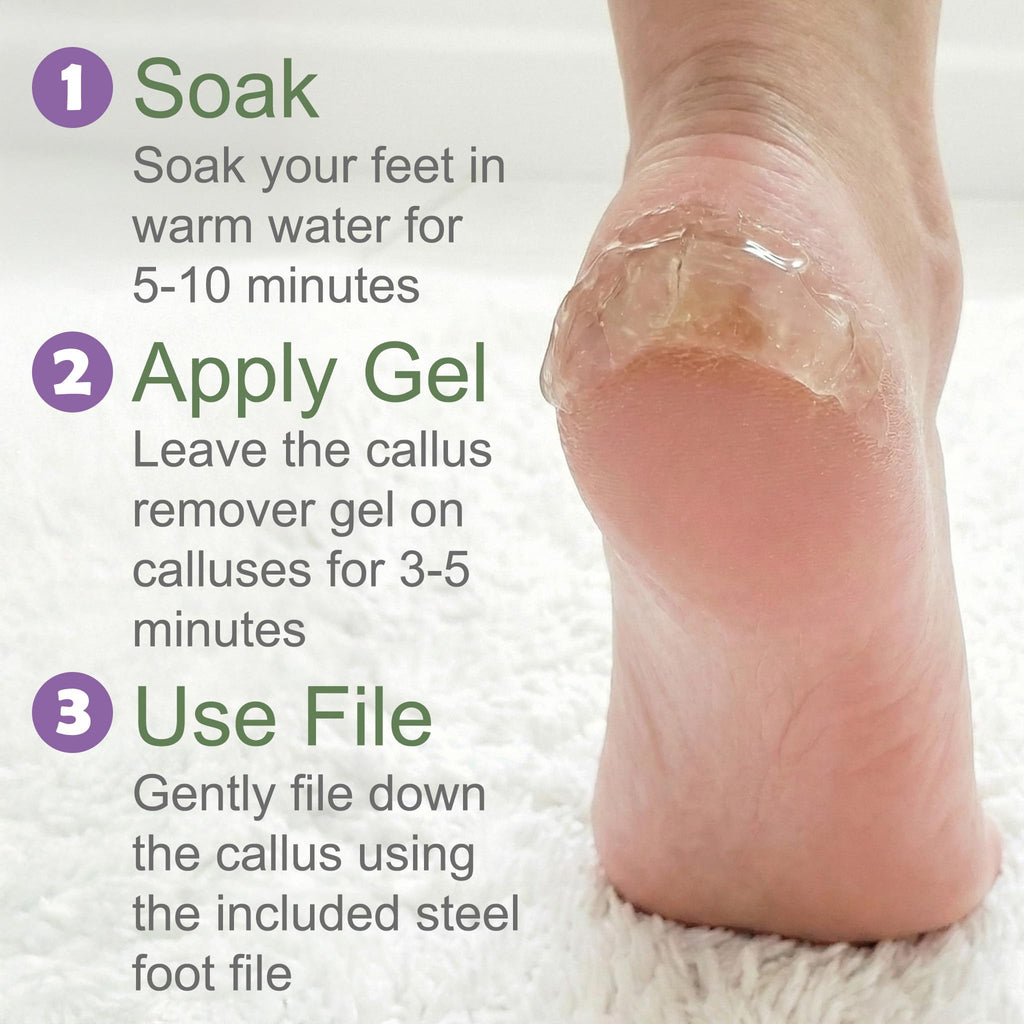 Foot Callus Remover Gel & File, 8 oz Extra Strength Callus Remover for Feet | Easily Softens and Removes Dead Hard Skin on Heels & Feet, Salon Results at Home in Minutes, Double-Sided Rasp Pedicure Tool