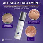 Biocorneum Silicone Scar Gel with SPF 30, Fast-Drying Scar Cream, 10g | Advanced Scar Treatment with Silishield®, Water Resistant Silicone Gel for Scars New & Old, Scar Cream for Surgical Scars