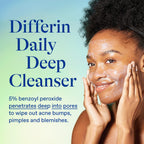 Differin Acne Face Wash, 5% Benzoyl Peroxide Daily Cleanser, 4oz | Gentle Acne Cleanser, Clears Breakouts, Sensitive Skin Safe, Benzoyl Peroxide Formula, Daily Use, 4 Oz